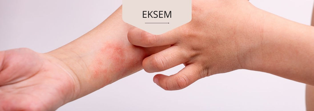 Kopia av Kopia av Skinandcare - socker