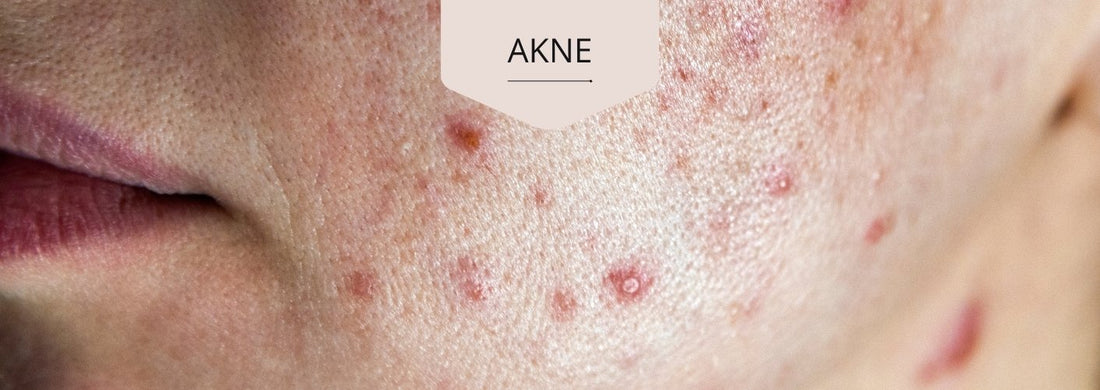 Kopia av Skinandcare - socker